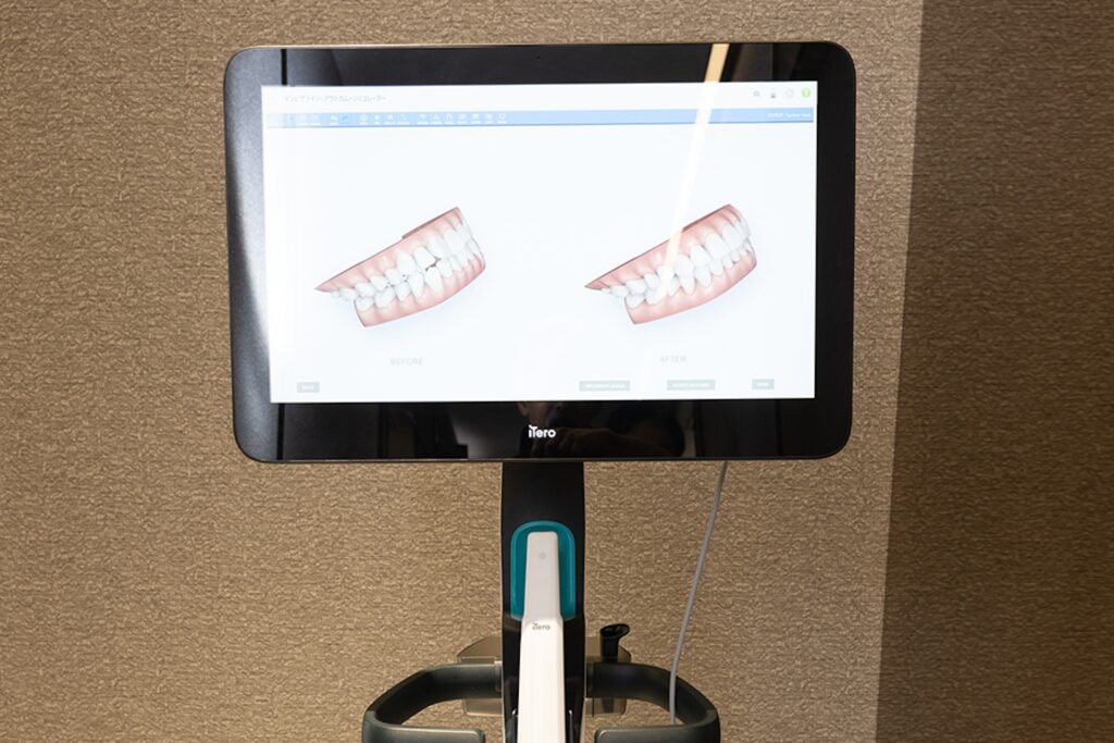 アップル歯科六本松の設備